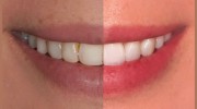 Smile Concepts
