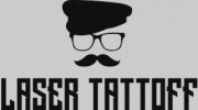 Laser Tattoff
