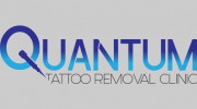 Quantum Tattoo Removal Clinic