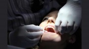 Lakeside Dental Care Yorketown