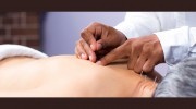 Poke Acupuncture