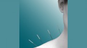 Peel Acupuncture