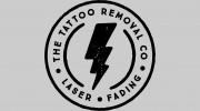 The Tattoo Removal