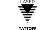 Laser Tattoff
