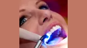 GlamSmile