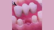 MS Dental