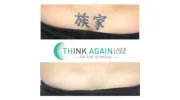 Think Again Laser Clinic