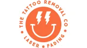 The Tattoo Removal Co.